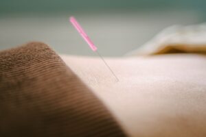 An acupuncture needle